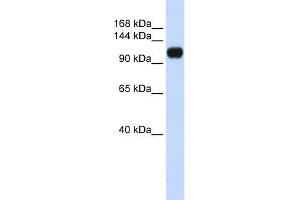 Human 293T; WB Suggested Anti-KIAA0692 Antibody Titration: 0. (ANKLE2 antibody  (Middle Region))