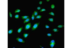 Immunofluorescent analysis of Hela cells using ABIN7174654 at dilution of 1:100 and Alexa Fluor 488-congugated AffiniPure Goat Anti-Rabbit IgG(H+L) (OGT antibody  (AA 606-1022))