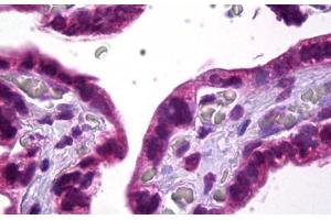 Anti-SKI antibody IHC staining of human placenta. (SKI antibody)
