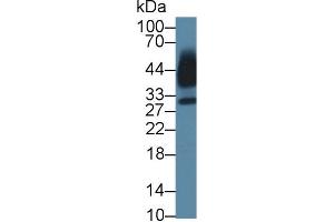 Detection of KLK13 in Human Saliva using Polyclonal Antibody to Kallikrein 13 (KLK13) (Kallikrein 13 antibody  (AA 25-261))