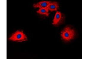 Immunofluorescent analysis of Claudin 6 staining in HuvEc cells. (Claudin 6 antibody  (Center))