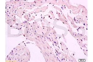 Formalin-fixed and paraffin embedded rat myocardium tissue labeled with Anti-SMURF2 Polyclonal Antibody, Unconjugated (ABIN753178) at 1:200 followed by conjugation to the secondary antibody and DAB staining (SMURF2 antibody  (AA 601-700))