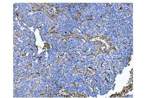 IHC analysis of CD13/ANPEP using anti-CD13/ANPEP antibody (ABIN7600088).