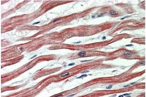 Staining of paraffin embedded Human Heart using EPM2AIP1 antibody at 5 µg/ml. (EPM2AIP1 antibody  (Internal Region))