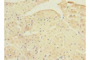 PPP1R3A antibody  (Regulatory Subunit 3A)