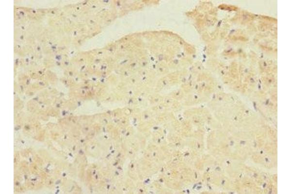 PPP1R3A antibody  (Regulatory Subunit 3A)