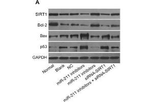 The protein expressions of SIRT1, Bcl-2, Bax, and p53 in each group(A) The protein strip chart, (B) the relative protein expression in seven groups, *, P<0. (Bcl-2 antibody  (AA 151-239))