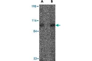 Western blot analysis of VPS53 in 293 cell lysate with VPS53 polyclonal antibody  at (A) 0. (VPS53 antibody  (Internal Region))