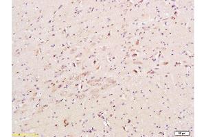 Formalin-fixed and paraffin embedded mouse brain tissue labeled with Anti-CHRNA7 Polyclonal Antibody, Unconjugated  at 1:200, followed by conjugation to the secondary antibody and DAB staining (CHRNA7 antibody  (AA 441-502))