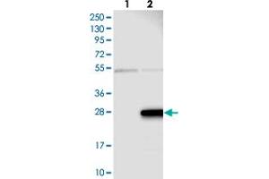 Western blot analysis of Lane 1: Negative control (vector only transfected HEK293T lysate), Lane 2: Over-expression Lysate (Co-expressed with a C-terminal myc-DDK tag (~3. (ZMAT5 antibody)