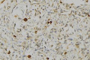 ABIN6276738 at 1/100 staining Human gastric tissue by IHC-P. (HLA-DRA antibody)