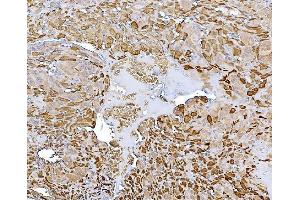 IHC analysis of CHAT using anti-CHAT antibody (ABIN7600920). (Choline Acetyltransferase antibody  (AA 25-731))