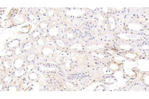 Immunohistochemistry (IHC) image for anti-Intercellular Adhesion Molecule 1 (ICAM1) (AA 41-464) antibody (ABIN7425926)