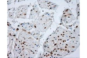 Image no. 2 for anti-Atrial Natriuretic Peptide Receptor 3 (NPR3) antibody (ABIN1499804) (NPR3 antibody)