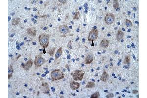 KCTD13 antibody was used for immunohistochemistry at a concentration of 4-8 ug/ml to stain Neural cells (arrows) in Human Brain. (KCTD13 antibody  (N-Term))