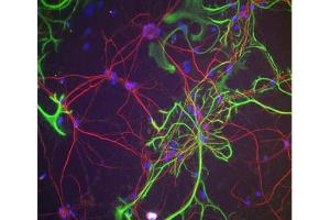 Neurofilament H Antibody - Immunofluorescence. (NEFH antibody)
