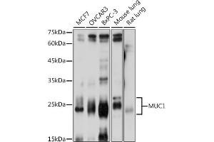 Western blot analysis of extracts of various cell lines, using MUC1 antibody (ABIN6131522, ABIN6144194, ABIN6144195 and ABIN6213810) at 1:1000 dilution.