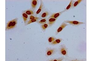 Immunocytochemistry analysis of Hela cells using ABIN7139191 at dilution of 1:100 (HIST1H1E antibody  (acLys63))