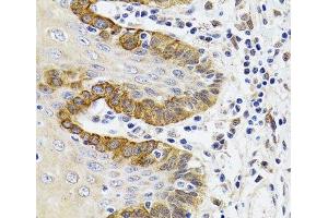 Immunohistochemistry of paraffin-embedded Human trachea using ESD Polyclonal Antibody at dilution of 1:100 (40x lens). (Esterase D antibody)