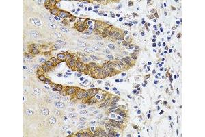Immunohistochemistry of paraffin-embedded Human trachea using ESD Polyclonal Antibody at dilution of 1:100 (40x lens).
