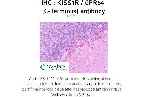 Image no. 2 for anti-KISS1 Receptor (KISS1R) (C-Term) antibody (ABIN1736238)