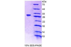 SDS-PAGE (SDS) image for Asialoglycoprotein Receptor 1 (ASGR1) (AA 77-289) protein (His tag) (ABIN1878634) (Asialoglycoprotein Receptor 1 Protein (ASGR1) (AA 77-289) (His tag))