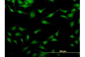 Immunofluorescence of monoclonal antibody to STAU2 on HeLa cell. (Double-stranded RNA-binding protein Staufen homolog 2 (STAU2) (AA 341-440) antibody)