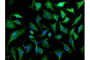 Immunofluorescence staining of U251 cells with ABIN7146919 at 1:100, counter-stained with DAPI. (CARD6 antibody  (AA 666-930))