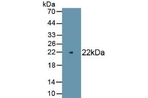 Detection of Recombinant PMP22, Rat using Polyclonal Antibody to Peripheral Myelin Protein 22 (PMP22) (PMP22 antibody)