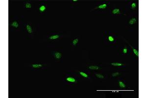 Immunofluorescence of purified MaxPab antibody to JMJD2D on HeLa cell.