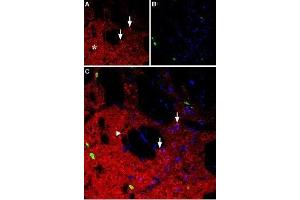 Expression of neuropeptide Y1 receptor in rat striatum - Immunohistochemical staining of rat striatum using Anti-NPY1R Antibody (ABIN7043371, ABIN7044668 and ABIN7044669). (NPY1R antibody  (AA 237-252))