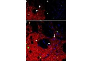 Expression of neuropeptide Y1 receptor in rat striatum - Immunohistochemical staining of rat striatum using Anti-NPY1R Antibody (ABIN7043371, ABIN7044668 and ABIN7044669).