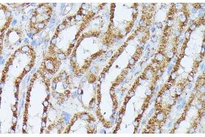 Immunohistochemistry of paraffin-embedded Mouse kidney using PPP2CB Polyclonal Antibody at dilution of 1:100 (40x lens). (PPP2CB antibody)