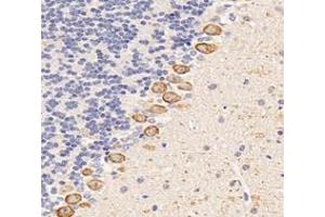 Immunohistochemistry analysis of paraffin-embedded mouse cerebellum using,Dgkz (ABIN7073722) at dilution of 1: 6000 (DGKZ antibody)