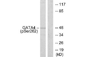 Western blot analysis of extracts from 293 cells, using GATA4 (Phospho-Ser262) antibody. (GATA4 antibody  (pSer262))