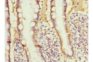 Immunohistochemistry of paraffin-embedded human small intestine tissue using ABIN7167845 at dilution of 1:100 (RBP2 antibody  (AA 1-134))