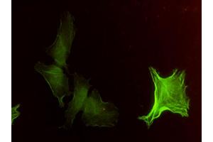 Immunofluorescence of monoclonal antibody to ACTA2 on HeLa cell. (Smooth Muscle Actin antibody  (AA 1-377))
