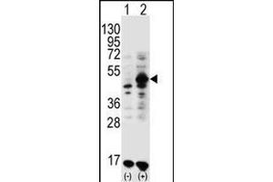 Western blot analysis of GDF9 (arrow) using rabbit polyclonal GDF9 Antibody (M45) (ABIN388822 and ABIN2839140).