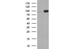 HEK293T cells were transfected with the pCMV6-ENTRY control (Left lane) or pCMV6-ENTRY CTNNB1 (Right lane) cDNA for 48 hrs and lysed. (CTNNB1 antibody)
