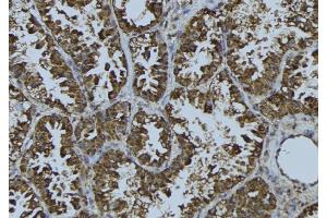 ABIN6275710 at 1/100 staining Mouse testis tissue by IHC-P. (TACC3 antibody  (C-Term))