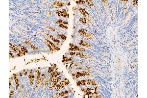 anti-Platelet Factor 4 (PF4) (Internal Region) antibody