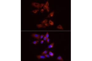 Immunofluorescence analysis of PC-3 cells using PYGB Rabbit pAb  at dilution of 1:100 (40x lens).
