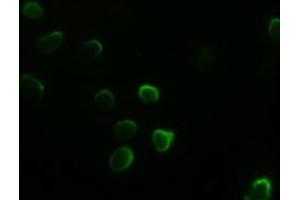Anti-GATA4 mouse monoclonal antibody (ABIN2452678) immunofluorescent staining of HeLa cells transiently transfected by pCMV6-ENTRY GATA4 (RC210945) (GATA4 antibody  (AA 296-442))