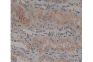 Used in DAB staining on fromalin fixed paraffin- embedded Kidney tissue (PTPRK antibody  (AA 1185-1440))