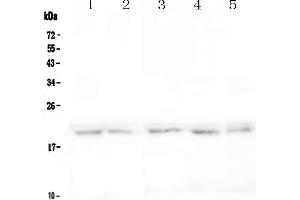 Western blot analysis of BCMA using anti-BCMA antibody . (BCMA antibody  (AA 1-49))