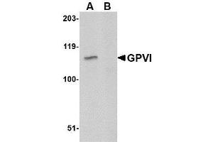 Western blot analysis of GPVI in A20 lysate with AP30378PU-N GPVI antibody at 1μg/ml in either the absence or (B) the presence of blocking peptide. (GP6 antibody  (C-Term))