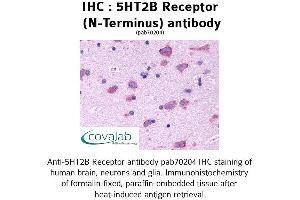 Image no. 1 for anti-Serotonin Receptor 2B (HTR2B) (Extracellular Domain), (N-Term) antibody (ABIN1731365) (Serotonin Receptor 2B antibody  (Extracellular Domain, N-Term))
