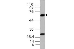 Image no. 1 for anti-Parathyroid Hormone (PTH) (AA 1-236) antibody (ABIN5027426) (PTH antibody  (AA 1-236))