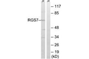Western blot analysis of extracts from Jurkat cells, using RGS7 Antibody.