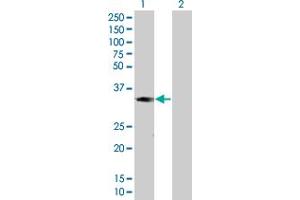 Lane 1: MAD2L1BP transfected lysate ( 30. (MAD2L1BP 293T Cell Transient Overexpression Lysate(Denatured))